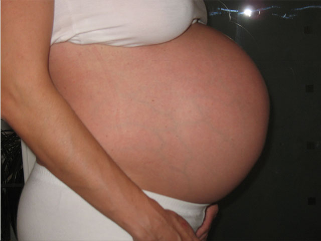 38. teden nosečnosti; tik pred porodom