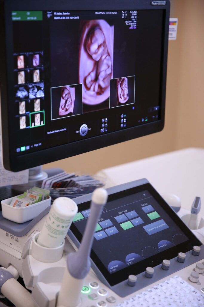 ZCD Zdravstveni center Dravlje, nosečnost, nuhalna svetlina, nifty