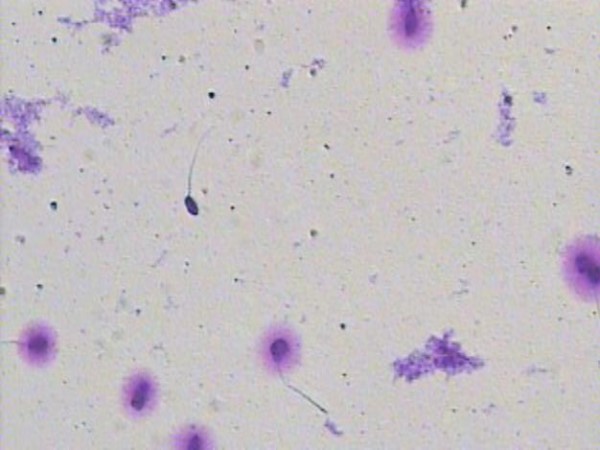 Spermiogram ZC Dravlje