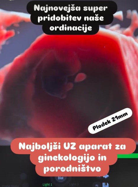 Nov ultrazvočni aparat v ZC Dravlje